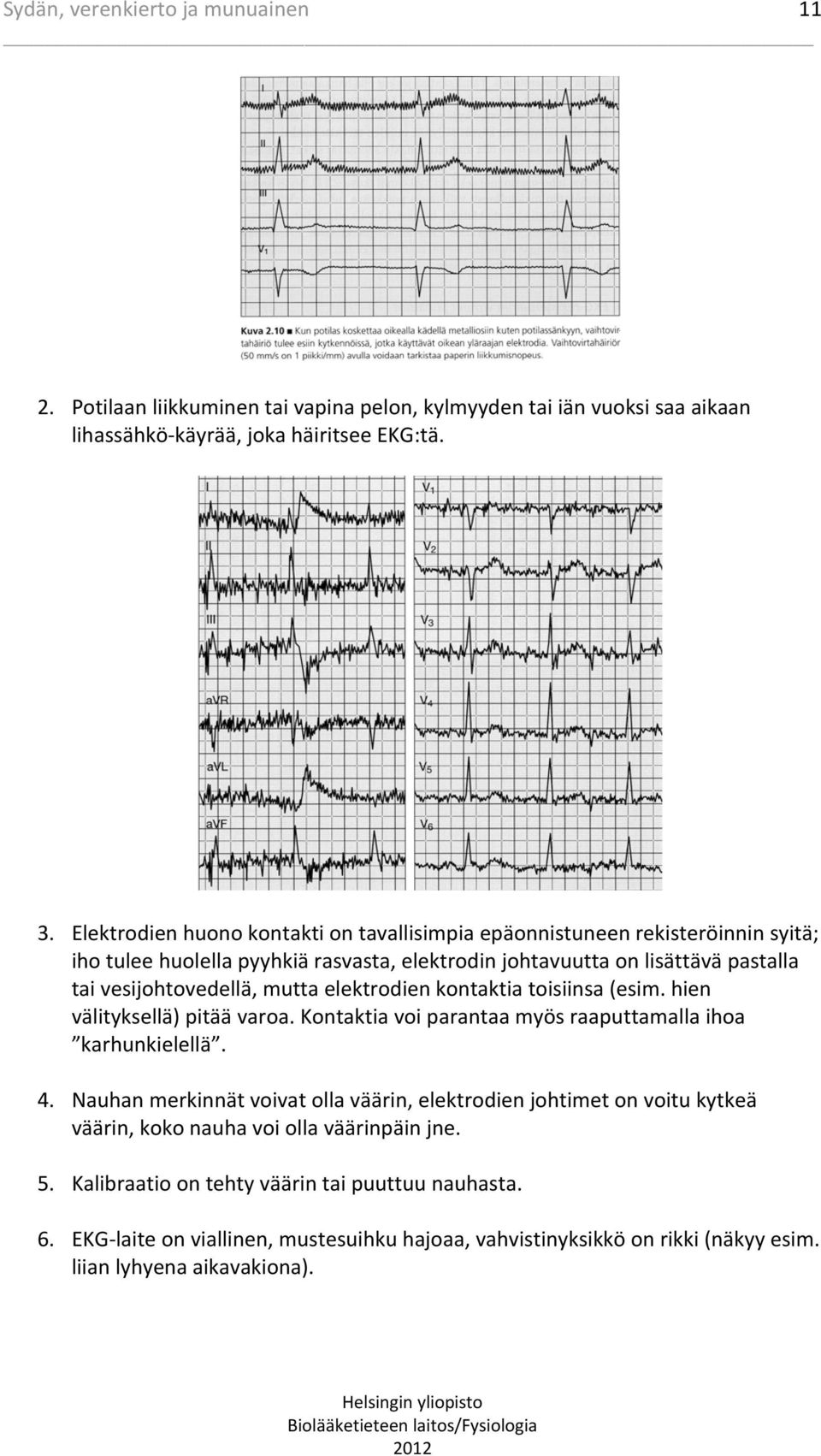 mutta elektrodien kontaktia toisiinsa (esim. hien välityksellä) pitää varoa. Kontaktia voi parantaa myös raaputtamalla ihoa karhunkielellä. 4.