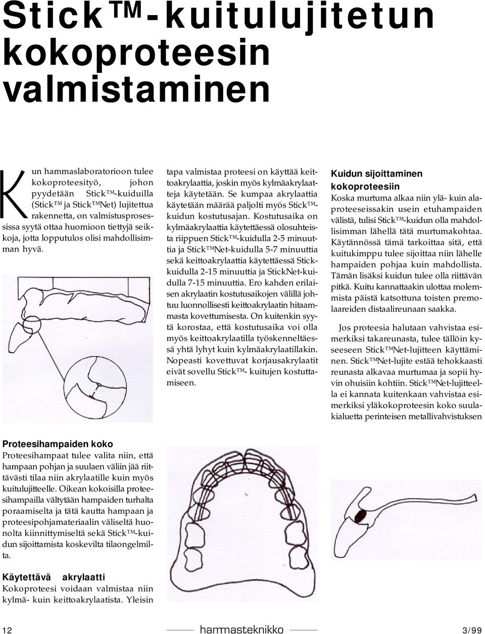 Se kumpaa akrylaattia käytetään määrää paljolti myös Stick kuidun kostutusajan.