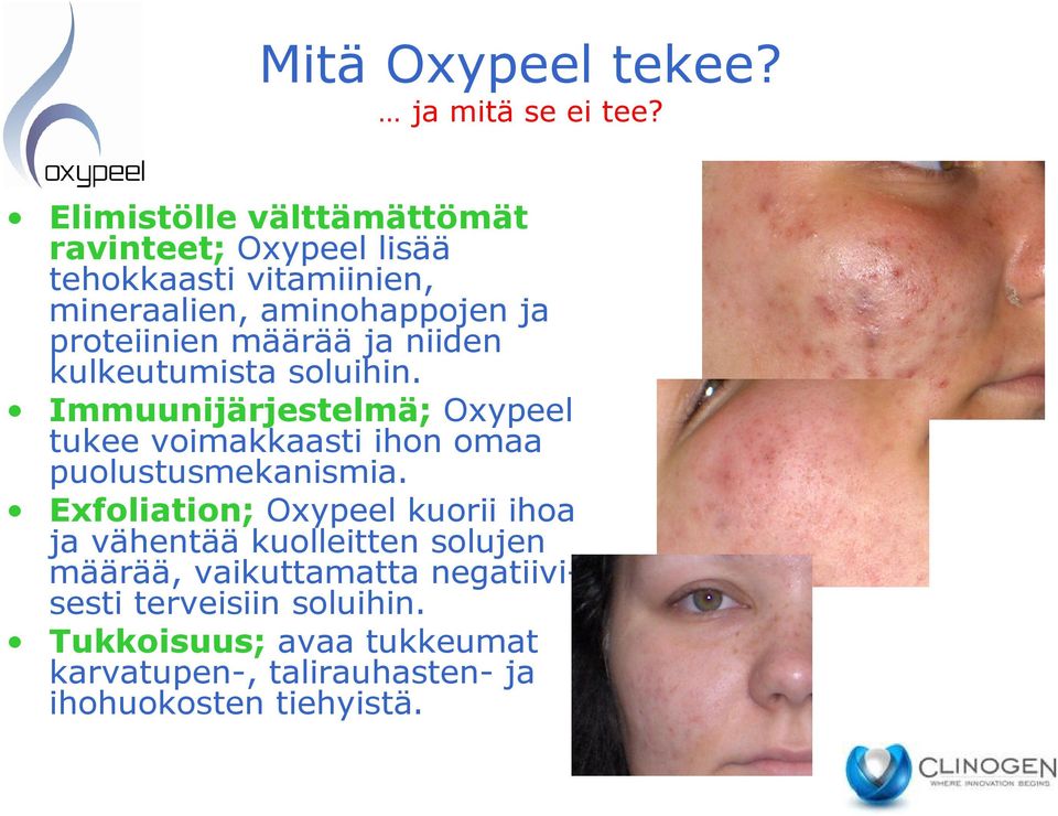 määrää ja niiden kulkeutumista soluihin. Immuunijärjestelmä; Oxypeel tukee voimakkaasti ihon omaa puolustusmekanismia.