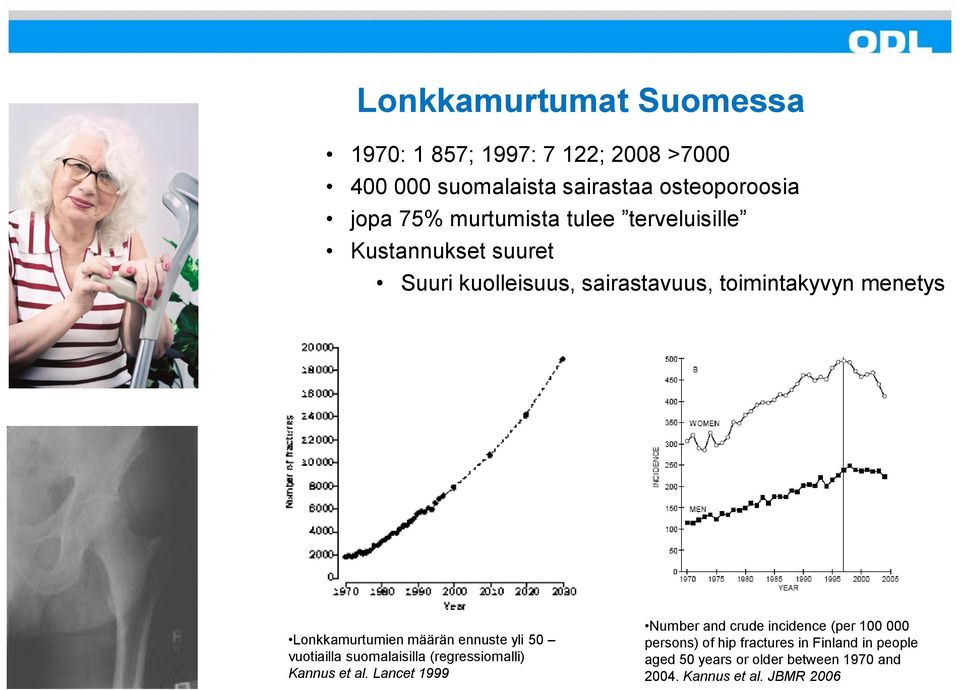 Lonkkamurtumien määrän ennuste yli 50 vuotiailla suomalaisilla (regressiomalli) Kannus et al.