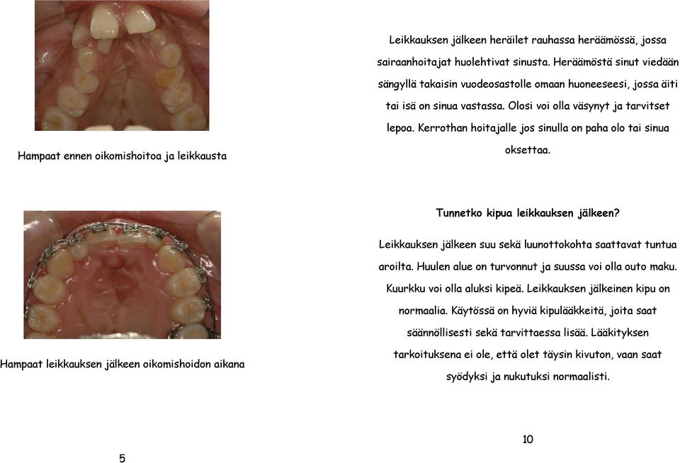 Kerrothan hoitajalle jos sinulla on paha olo tai sinua Hampaat ennen oikomishoitoa ja leikkausta oksettaa. 2 Tunnetko kipua leikkauksen jälkeen?