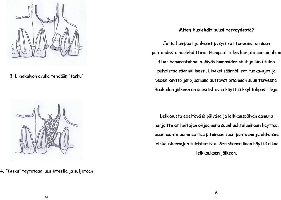 Lisäksi säännölliset ruoka-ajat ja veden käyttö janojuomana auttavat pitämään suun terveenä. Ruokailun jälkeen on suositeltavaa käyttää ksylitolipastilleja.