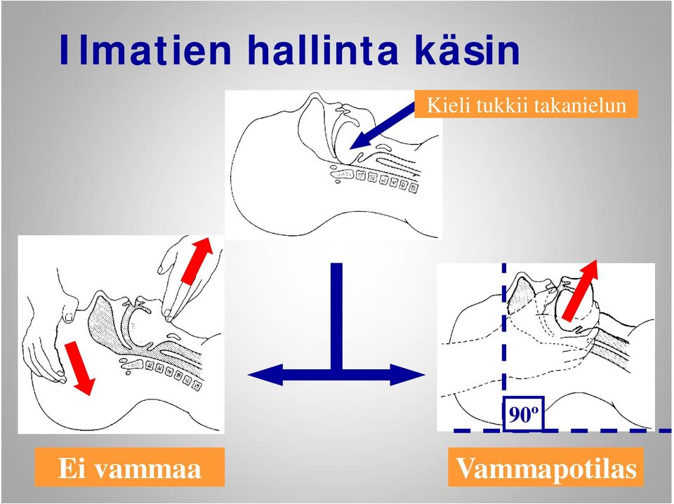 takanielun 90º Ei