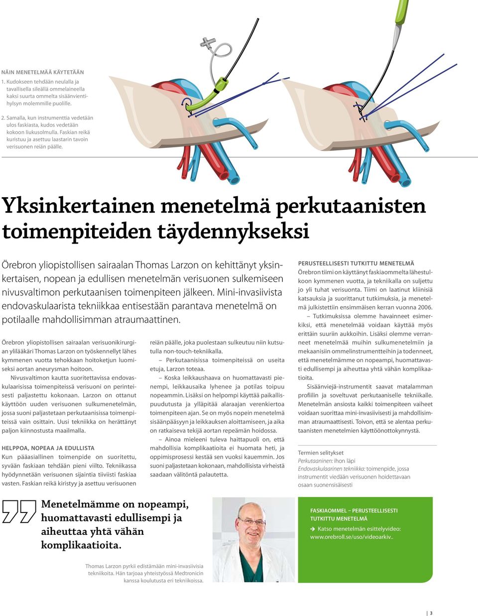Yksinkertainen menetelmä perkutaanisten toimenpiteiden täydennykseksi Örebron yliopistollisen sairaalan Thomas Larzon on kehittänyt yksinkertaisen, nopean ja edullisen menetelmän verisuonen