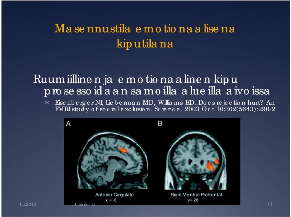 Eisenberger NI, Lieberman MD, Williams KD. Does rejection hurt?