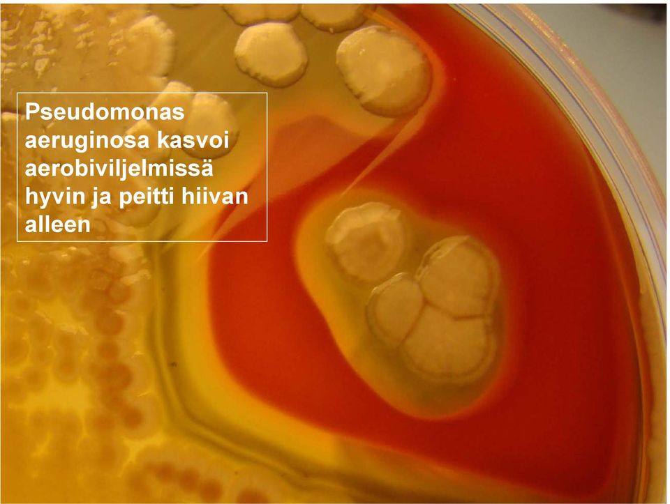 aerobiviljelmissä