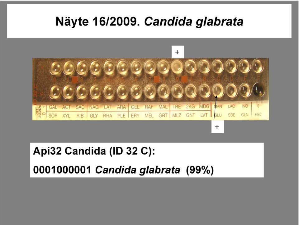 Api32 Candida (ID 32