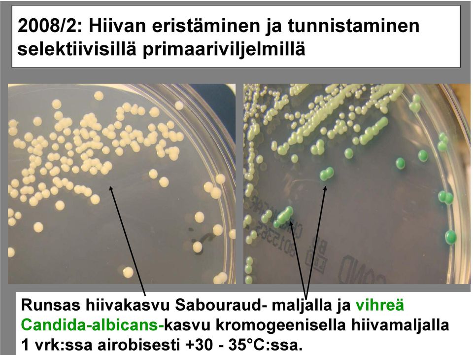 Sabouraud- maljalla ja vihreä Candida-albicans-kasvu