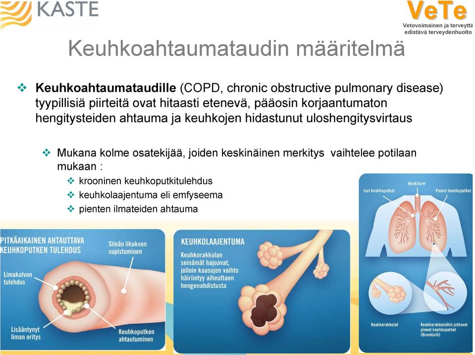 hidastunut uloshengitysvirtaus Mukana kolme osatekijää, joiden keskinäinen merkitys vaihtelee potilaan