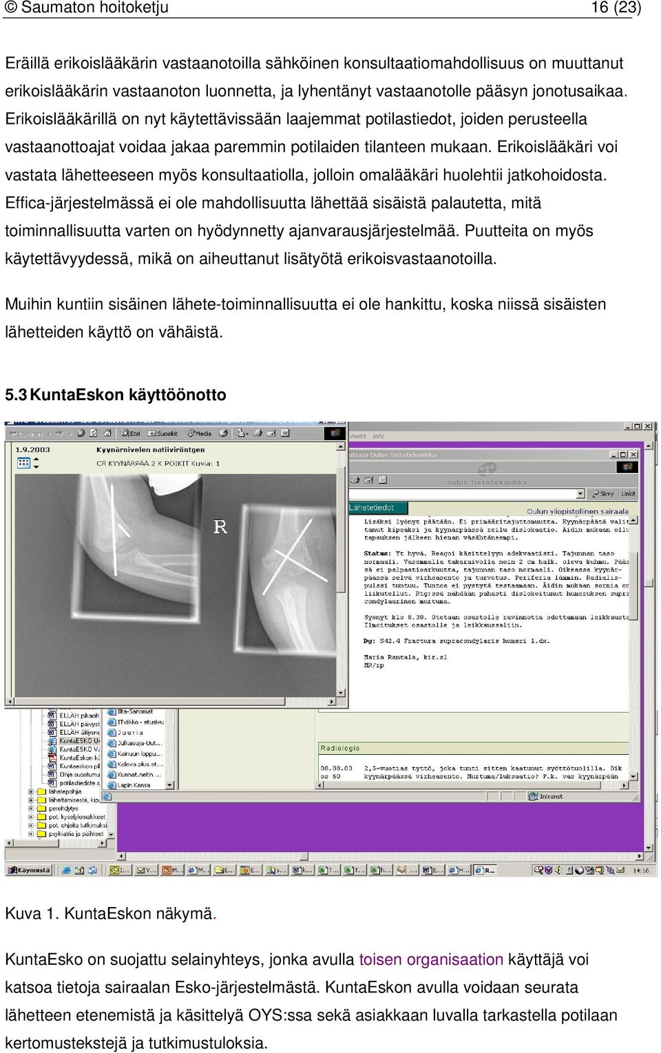 Erikoislääkäri voi vastata lähetteeseen myös konsultaatiolla, jolloin omalääkäri huolehtii jatkohoidosta.