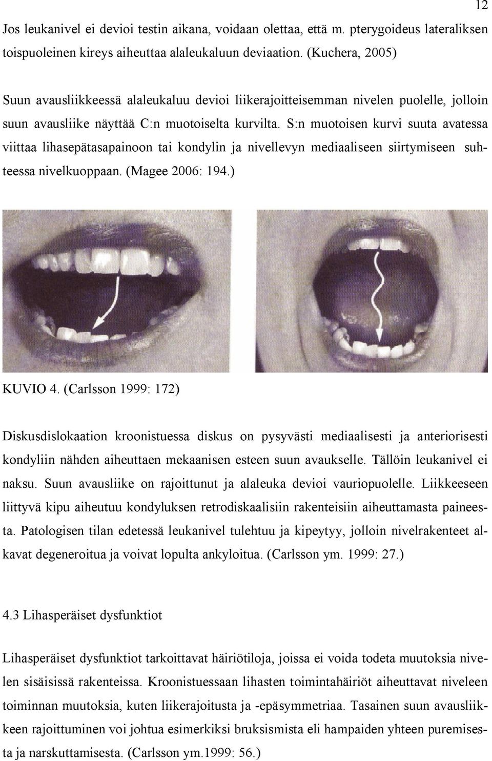 S:n muotoisen kurvi suuta avatessa viittaa lihasepätasapainoon tai kondylin ja nivellevyn mediaaliseen siirtymiseen suhteessa nivelkuoppaan. (Magee 2006: 194.) KUVIO 4.