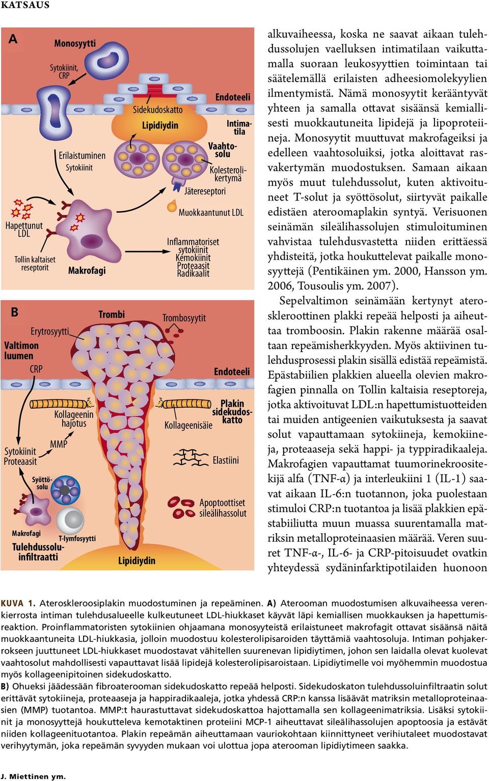 hajotus ahtoolu DL Endoteeli Sidekudoskatto Lipidiydin MMP Elastiini Syöttösolu Apoptoottiset sileälihassolut T-lymfosyytti Tulehdussoluinfiltraatti Lipidiydin ne saavat aikaan tulehbalkuvaiheessa,