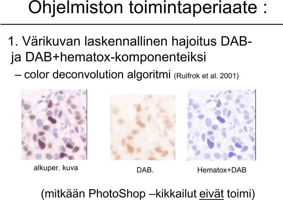 DAB+hematox-komponenteiksi color deconvolution algoritmi