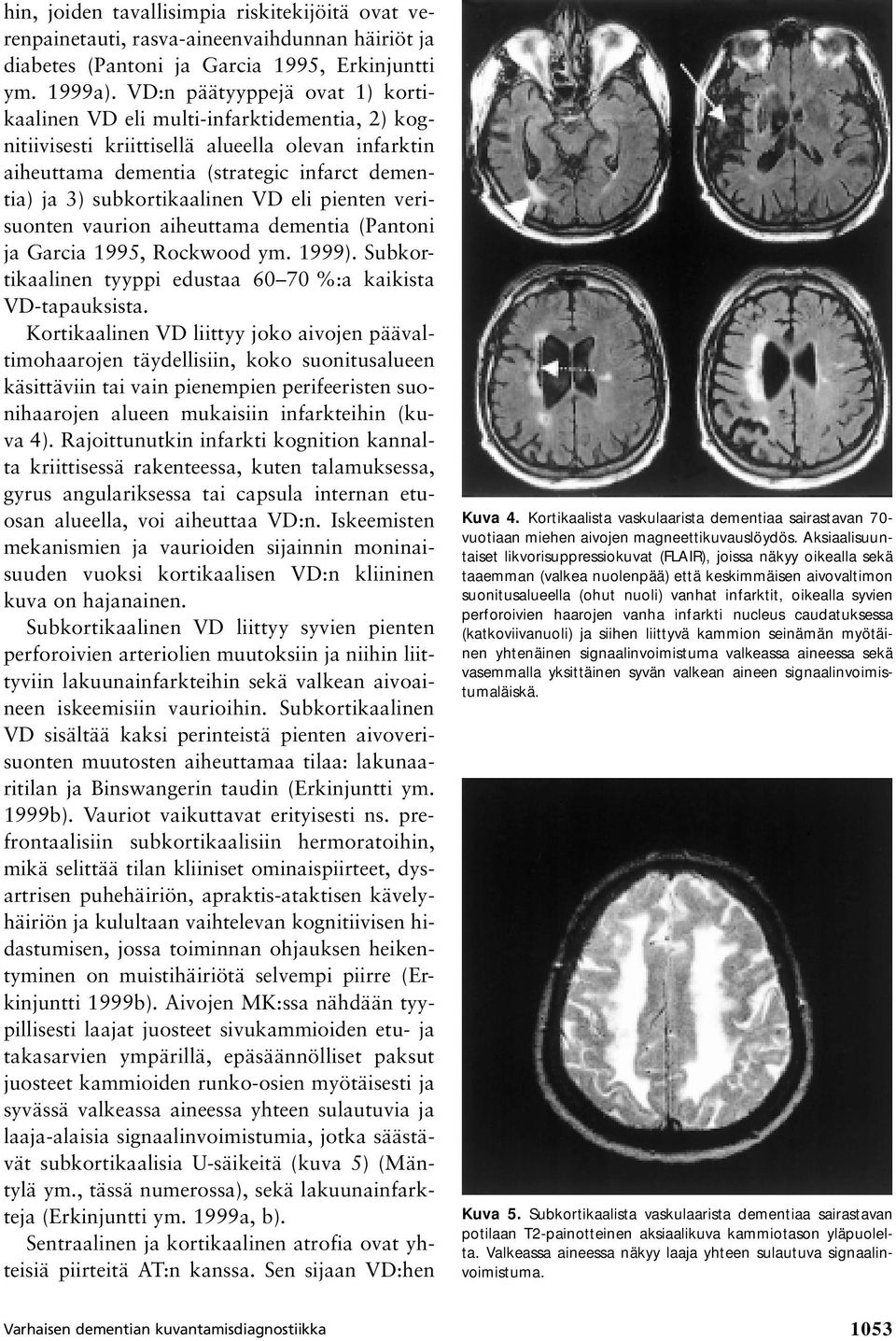 VD eli pienten verisuonten vaurion aiheuttama dementia (Pantoni ja Garcia 1995, Rockwood ym. 1999). Subkortikaalinen tyyppi edustaa 60 70 %:a kaikista VD-tapauksista.