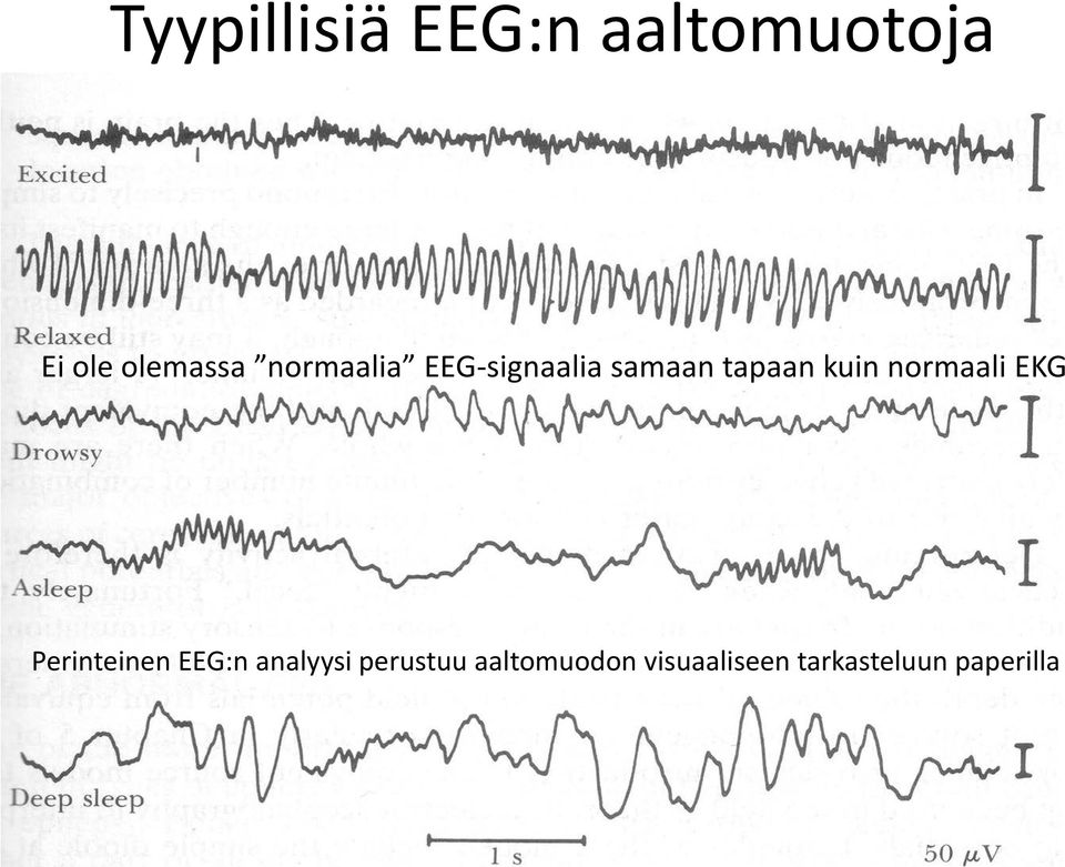 normaali EKG Perinteinen EEG:n analyysi
