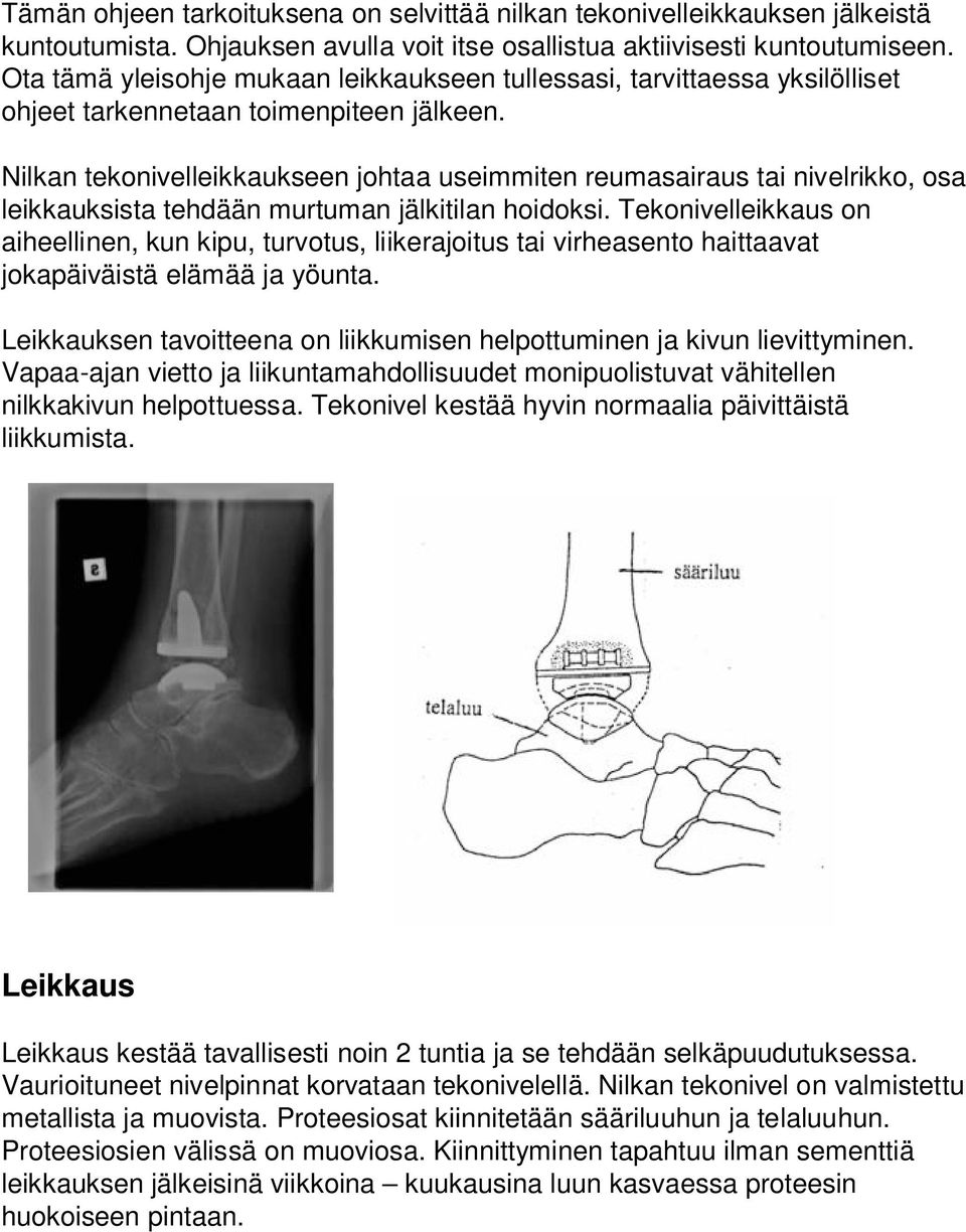 Nilkan tekonivelleikkaukseen johtaa useimmiten reumasairaus tai nivelrikko, osa leikkauksista tehdään murtuman jälkitilan hoidoksi.