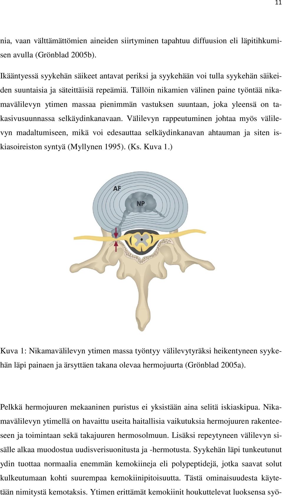 Tällöin nikamien välinen paine työntää nikamavälilevyn ytimen massaa pienimmän vastuksen suuntaan, joka yleensä on takasivusuunnassa selkäydinkanavaan.