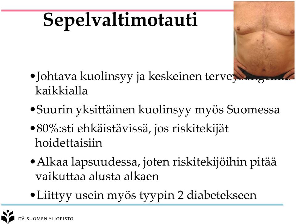 ehkäistävissä, jos riskitekijät hoidettaisiin Alkaa lapsuudessa, joten