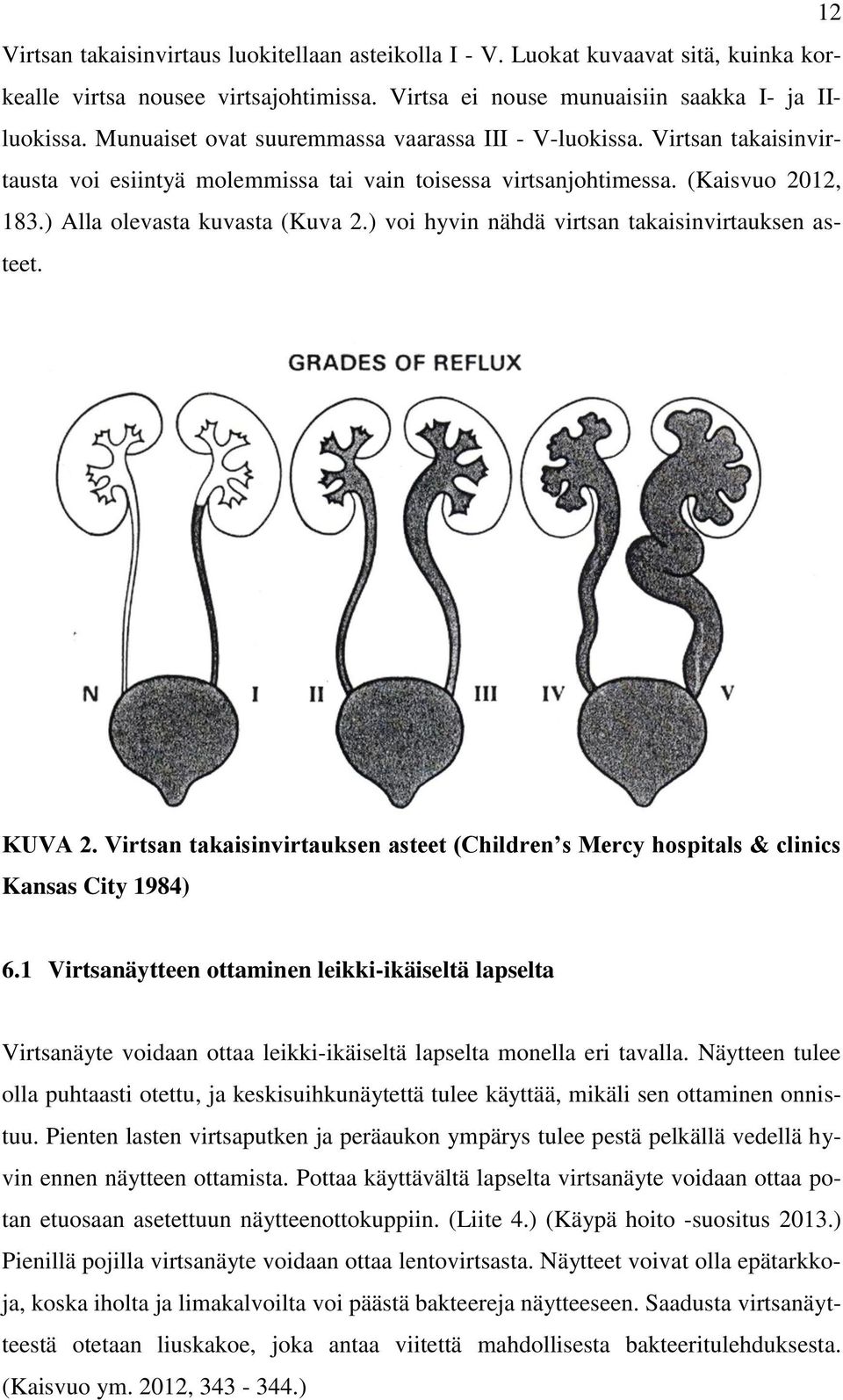 ) voi hyvin nähdä virtsan takaisinvirtauksen asteet. KUVA 2. Virtsan takaisinvirtauksen asteet (Children s Mercy hospitals & clinics Kansas City 1984) 6.