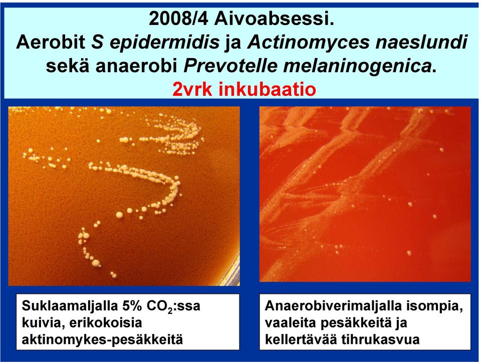 Prevotelle melaninogenica.
