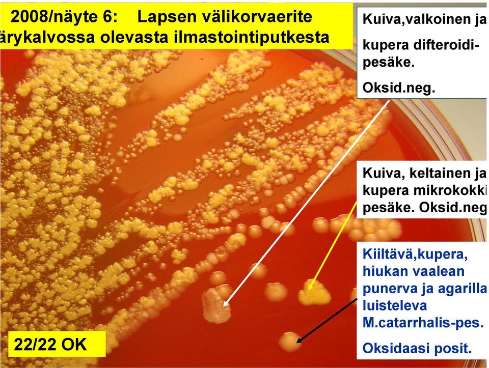 Kuiva, keltainen ja kupera mikrokokki pesäke. Oksid.