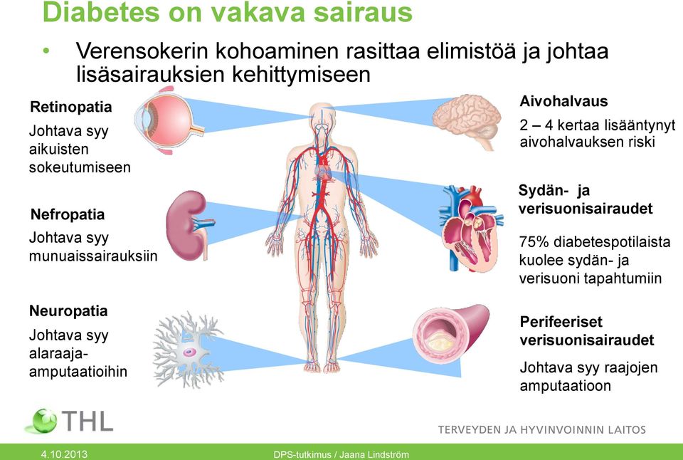 lisääntynyt aivohalvauksen riski Sydän- ja verisuonisairaudet 75% diabetespotilaista kuolee sydän- ja verisuoni