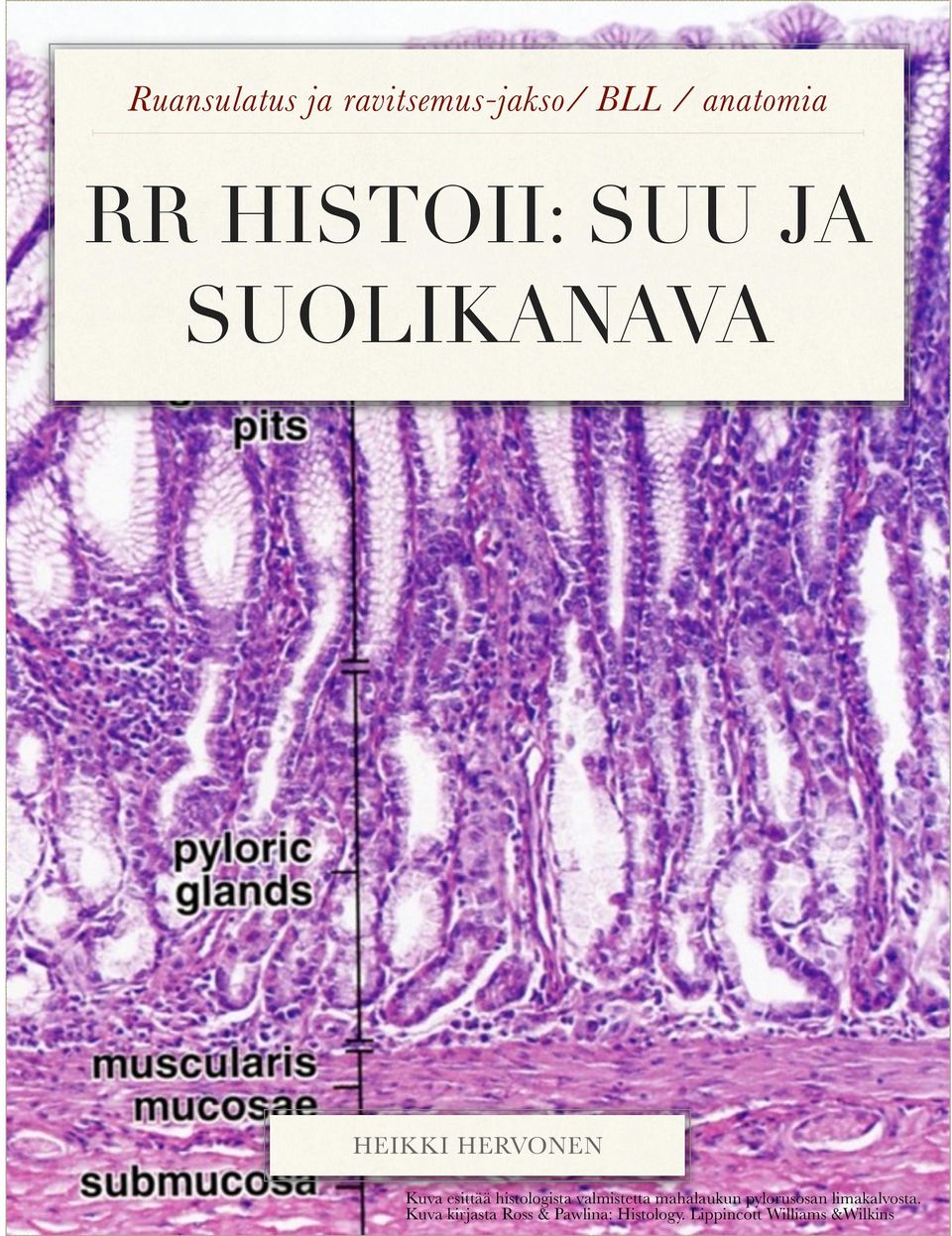 histologista valmistetta mahalaukun pylorusosan