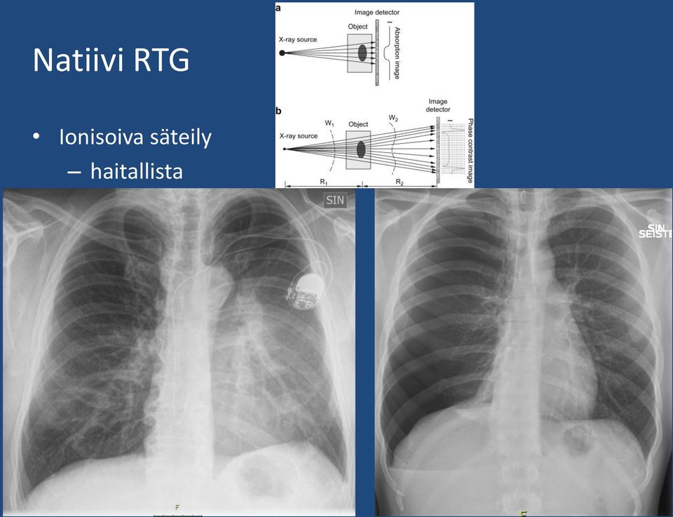 Ionisoiva