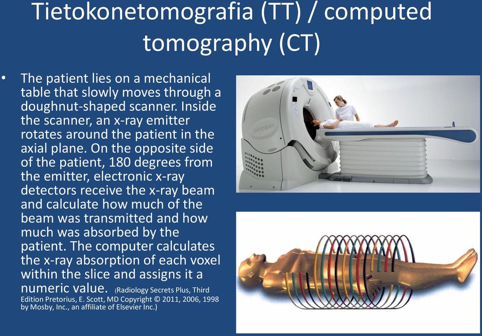 On the opposite side of the patient, 180 degrees from the emitter, electronic x-ray detectors receive the x-ray beam and calculate how much of the beam was transmitted