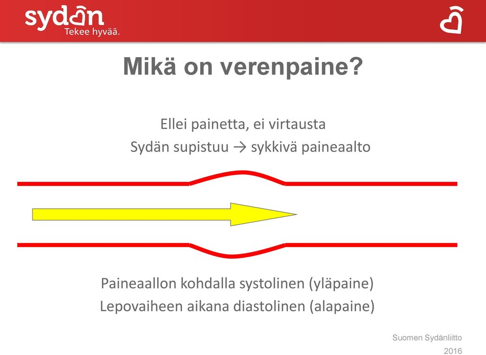 supistuu sykkivä paineaalto Paineaallon