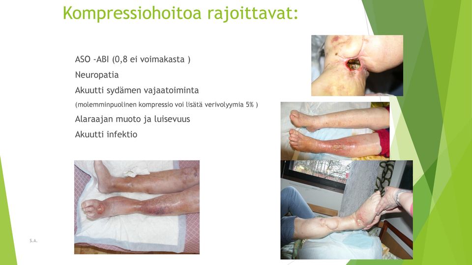 vajaatoiminta (molemminpuolinen kompressio voi