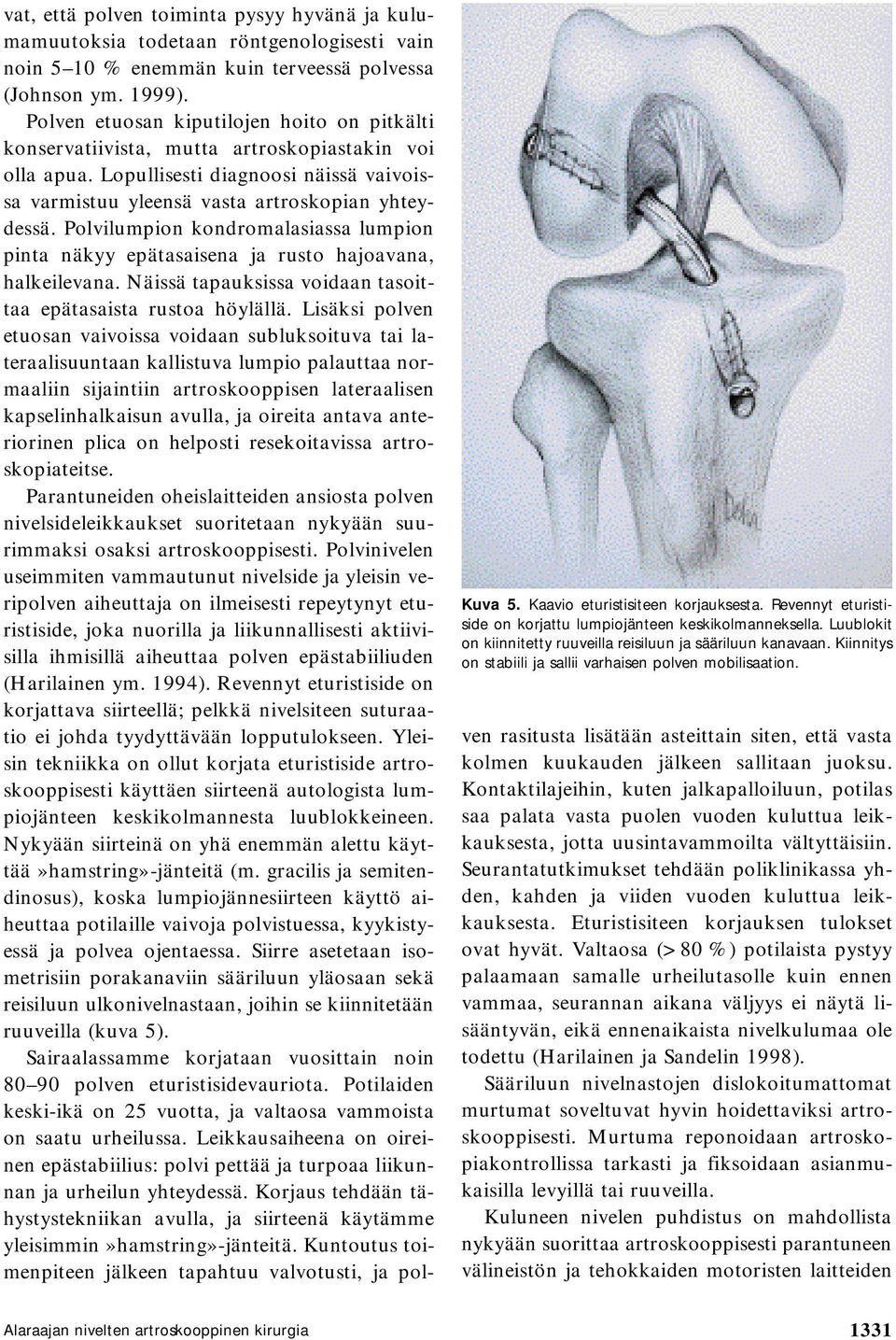 vat, että polven toiminta pysyy hyvänä ja kulumamuutoksia todetaan röntgenologisesti vain noin 5 10 % enemmän kuin terveessä polvessa (Johnson ym. 1999).