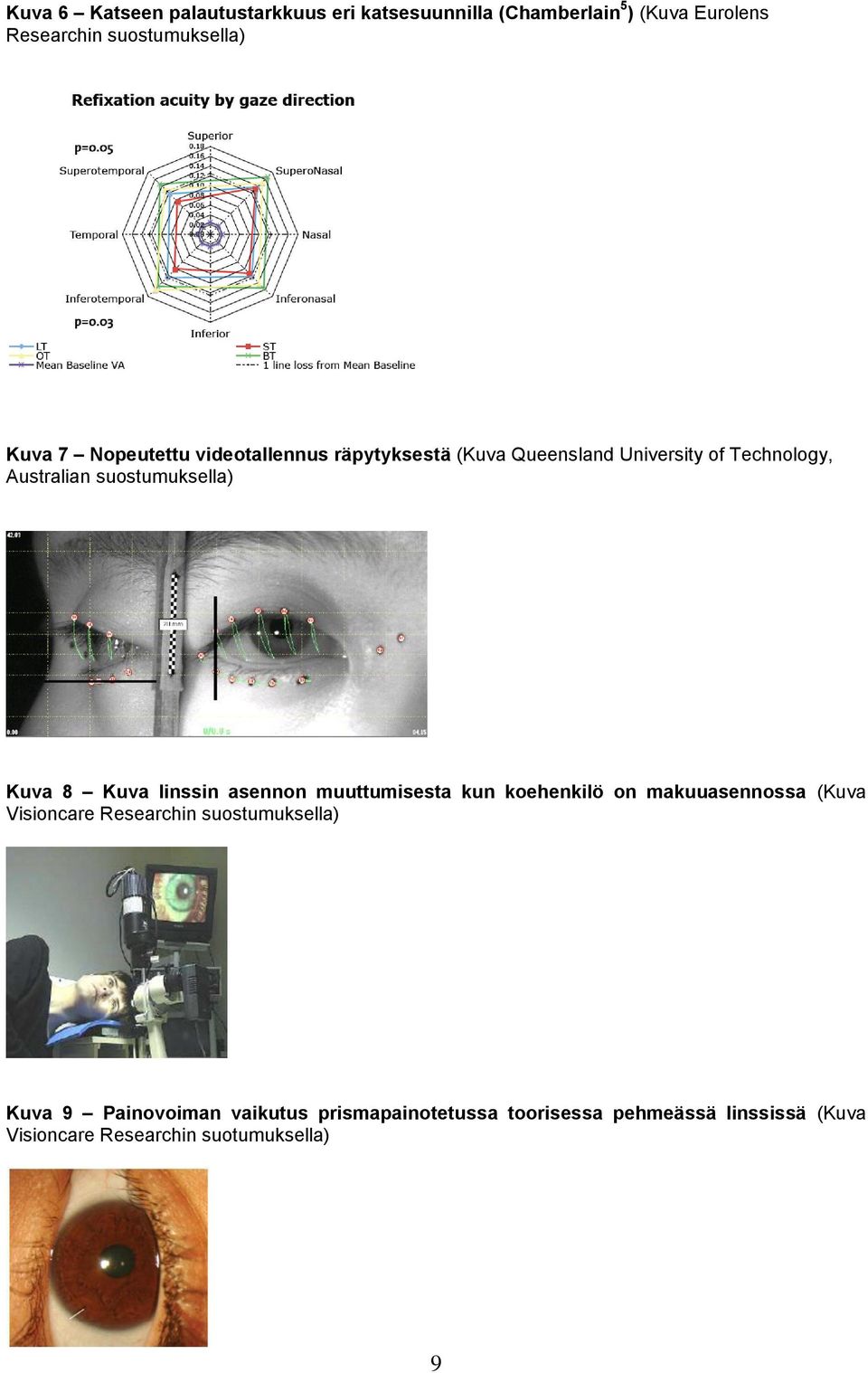 Kuva linssin asennon muuttumisesta kun koehenkilö on makuuasennossa (Kuva Visioncare Researchin suostumuksella) Kuva