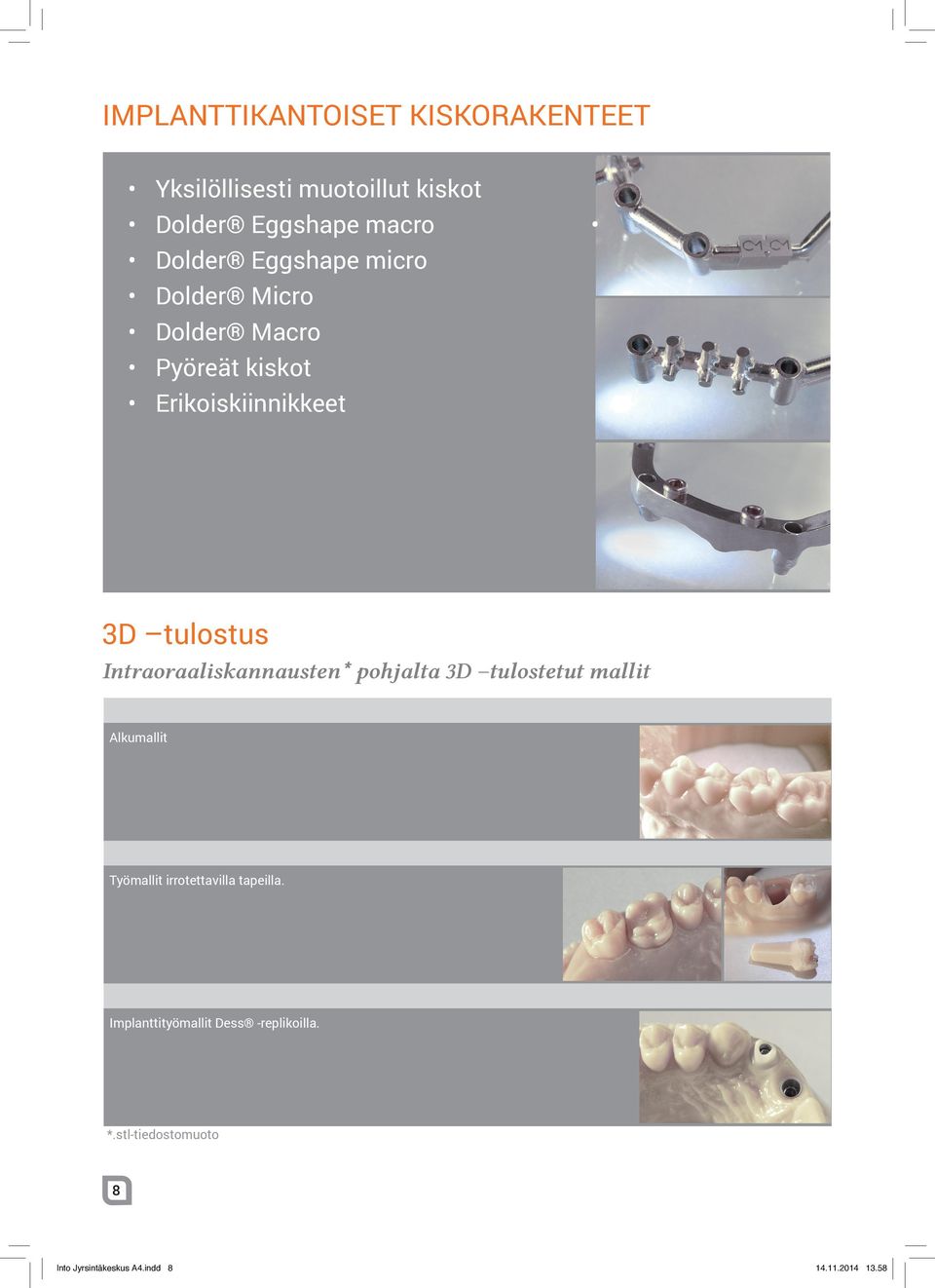 Intraoraaliskannausten* pohjalta 3D tulostetut mallit Alkumallit Työmallit irrotettavilla