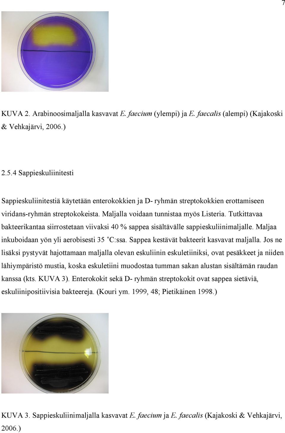 Tutkittavaa bakteerikantaa siirrostetaan viivaksi 40 % sappea sisältävälle sappieskuliinimaljalle. Maljaa inkuboidaan yön yli aerobisesti 35 C:ssa. Sappea kestävät bakteerit kasvavat maljalla.