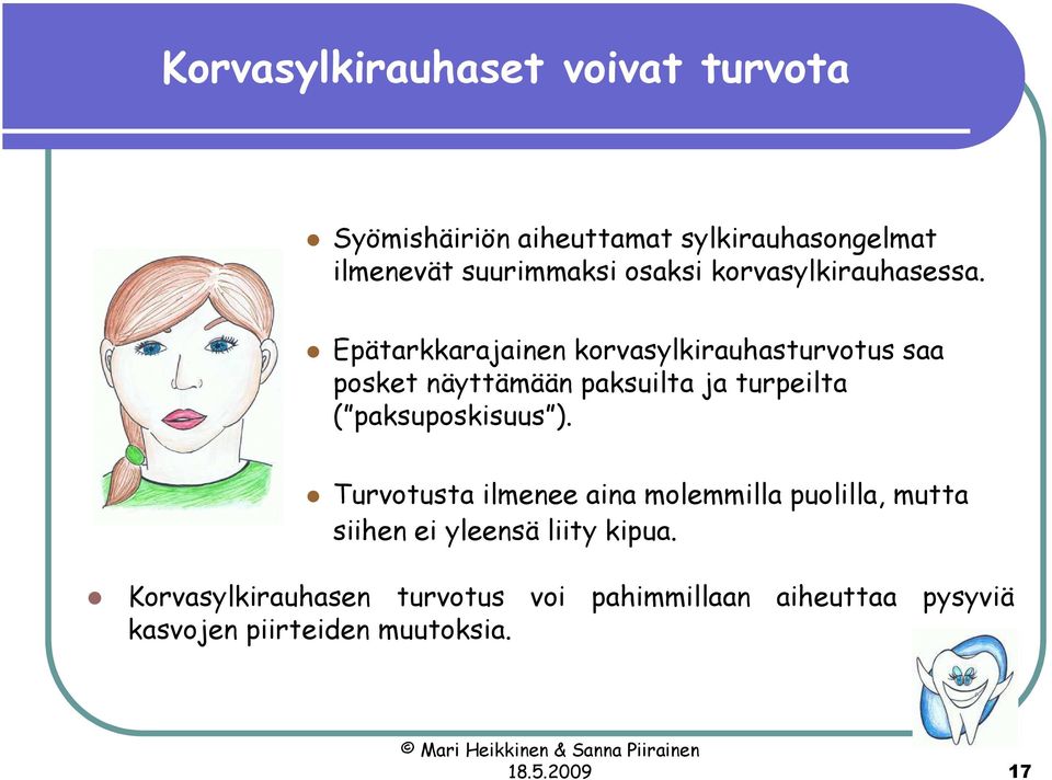 Epätarkkarajainen korvasylkirauhasturvotus saa posket näyttämään paksuilta ja turpeilta ( paksuposkisuus ).