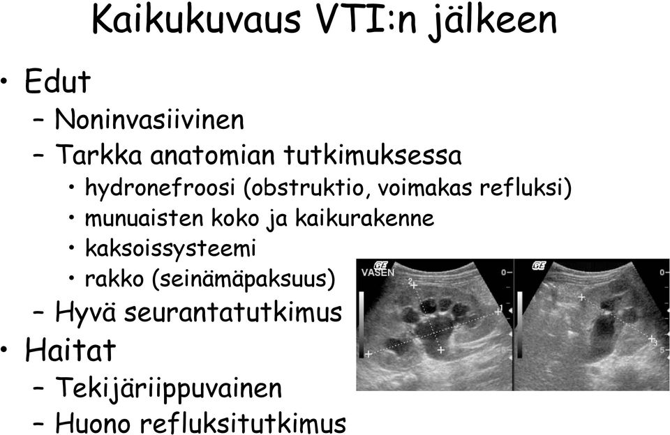 munuaisten koko ja kaikurakenne kaksoissysteemi rakko