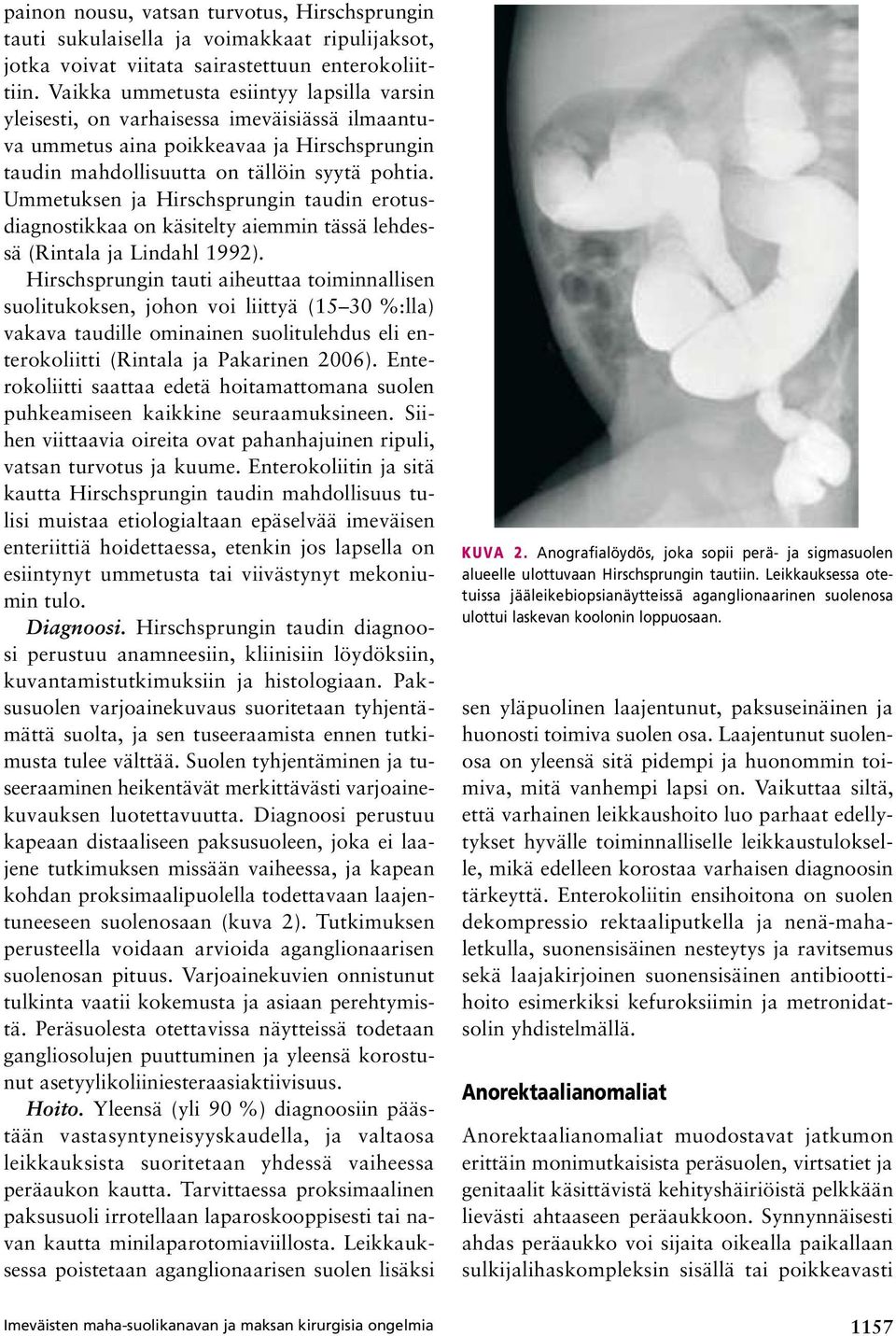 Ummetuksen ja Hirschsprungin taudin erotusdiagnostikkaa on käsitelty aiemmin tässä lehdessä (Rintala ja Lindahl 1992).