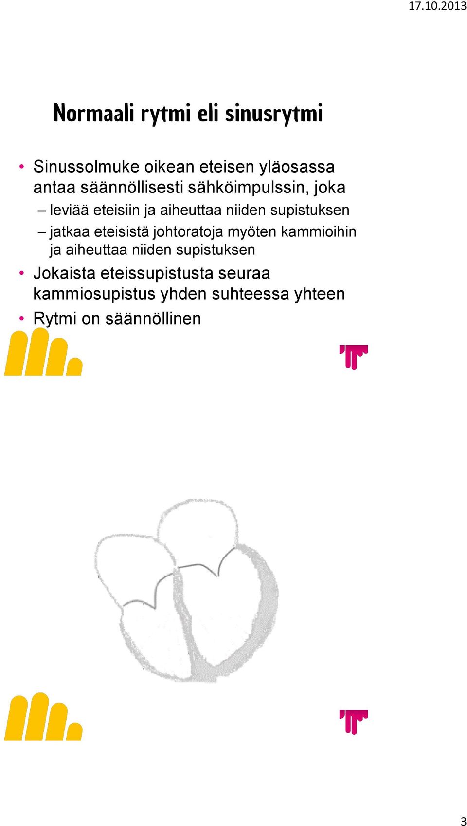 supistuksen jatkaa eteisistä johtoratoja myöten kammioihin ja aiheuttaa niiden