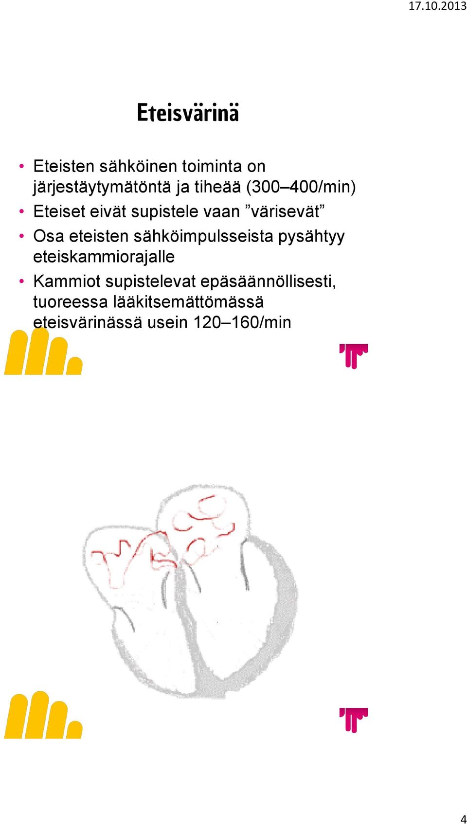 sähköimpulsseista pysähtyy eteiskammiorajalle Kammiot supistelevat