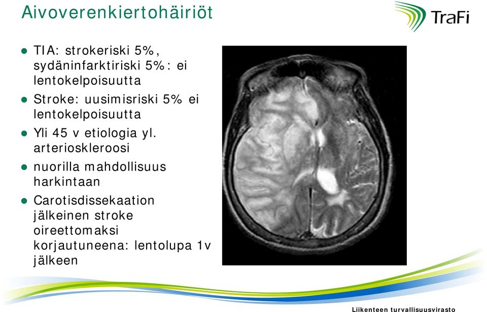 etiologia yl.