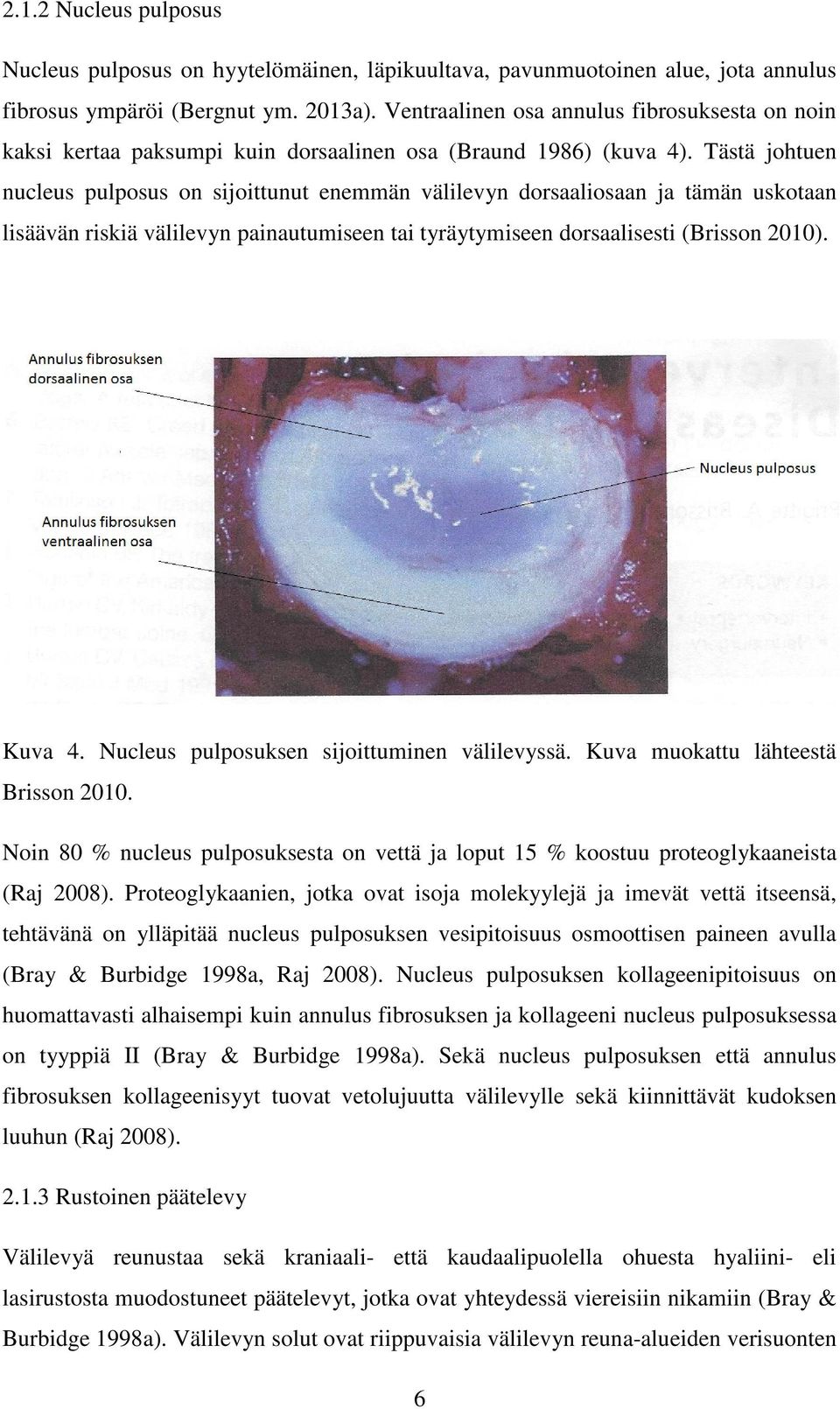 Tästä johtuen nucleus pulposus on sijoittunut enemmän välilevyn dorsaaliosaan ja tämän uskotaan lisäävän riskiä välilevyn painautumiseen tai tyräytymiseen dorsaalisesti (Brisson 2010). Kuva 4.