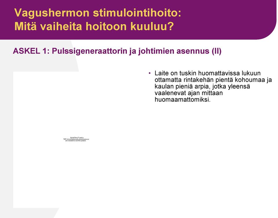 huomattavissa lukuun ottamatta rintakehän pientä kohoumaa ja kaulan pieniä