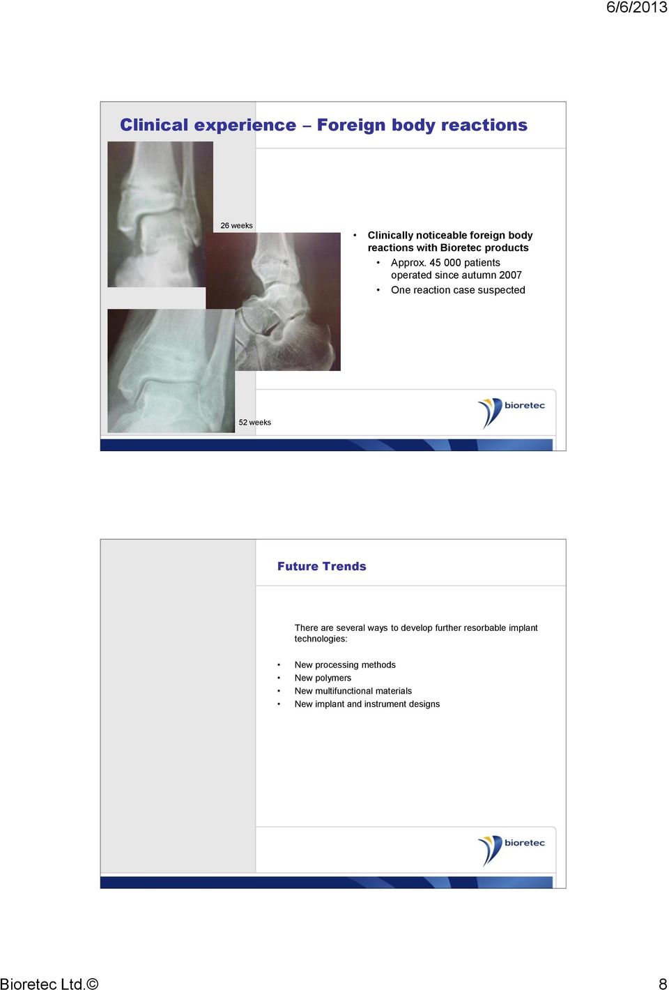 45 000 patients operated since autumn 2007 One reaction case suspected 52 weeks Future Trends There are