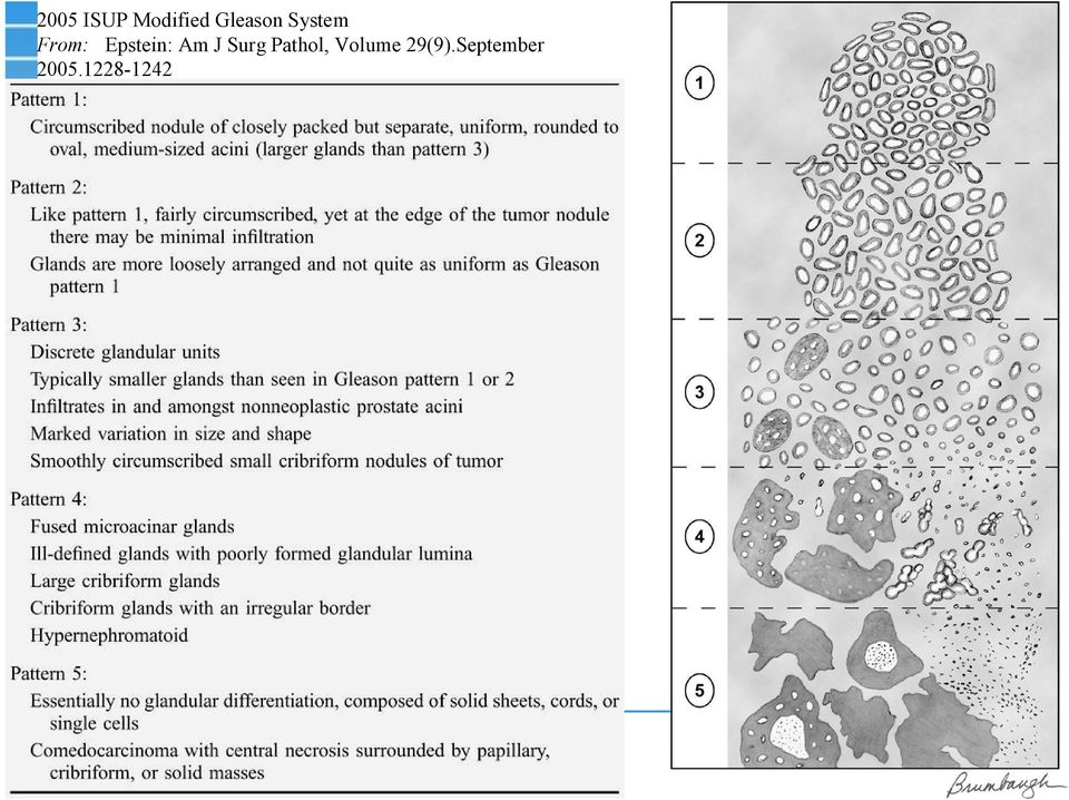 Surg Pathol, Volume 29(9).