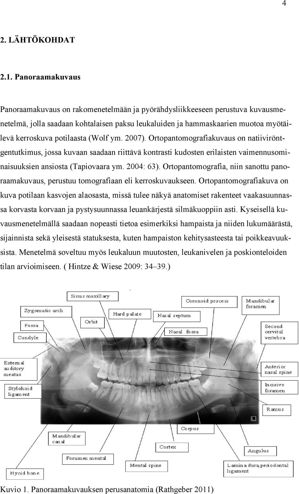 potilaasta (Wolf ym. 2007). Ortopantomografiakuvaus on natiiviröntgentutkimus, jossa kuvaan saadaan riittävä kontrasti kudosten erilaisten vaimennusominaisuuksien ansiosta (Tapiovaara ym. 2004: 63).