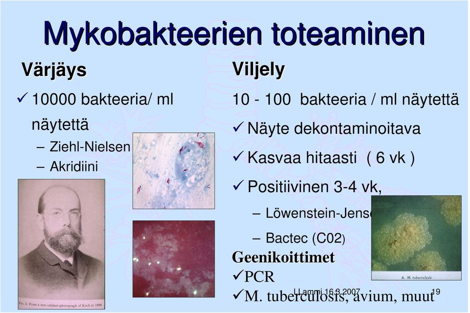 dekontaminoitava Kasvaa hitaasti ( 6 vk ) Positiivinen 3-4 vk,