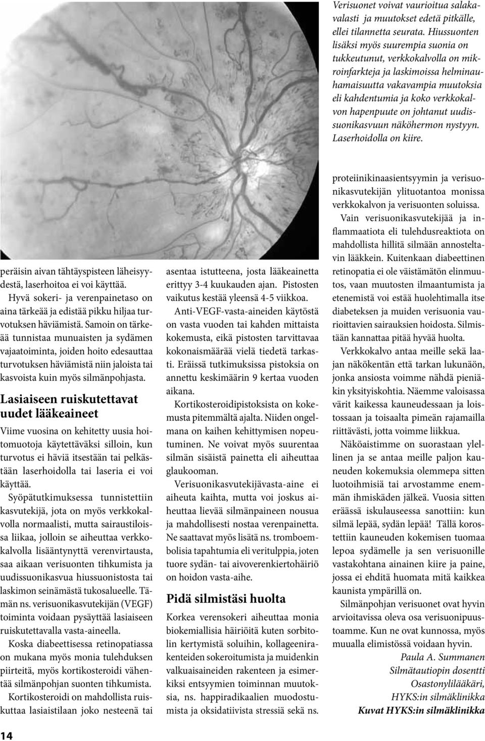 johtanut uudissuonikasvuun näköhermon nystyyn. Laserhoidolla on kiire. peräisin aivan tähtäyspisteen läheisyydestä, laserhoitoa ei voi käyttää.