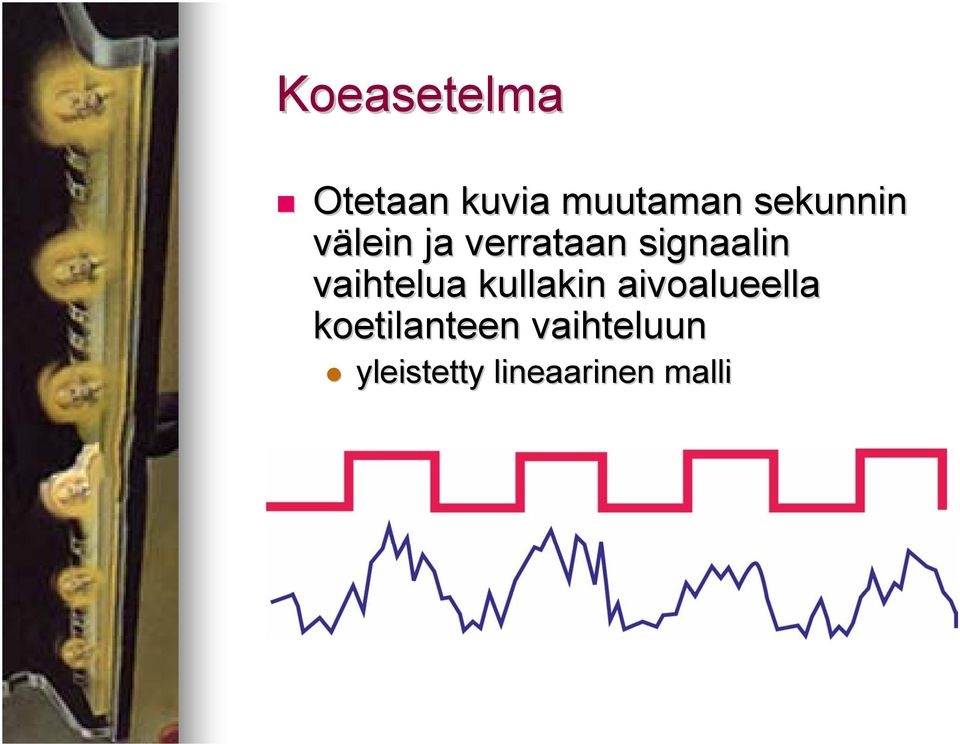 vaihtelua kullakin aivoalueella