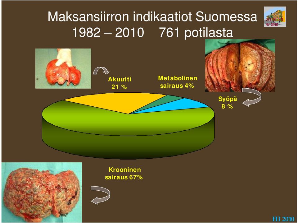 9/2010 Akuutti 21 % Metabolinen